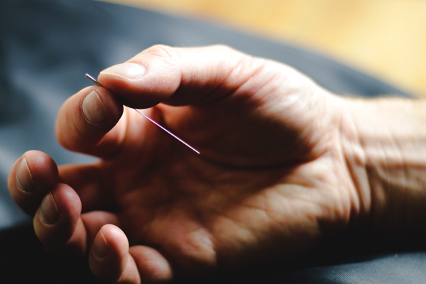 Accupuncture 1 600x400pix
